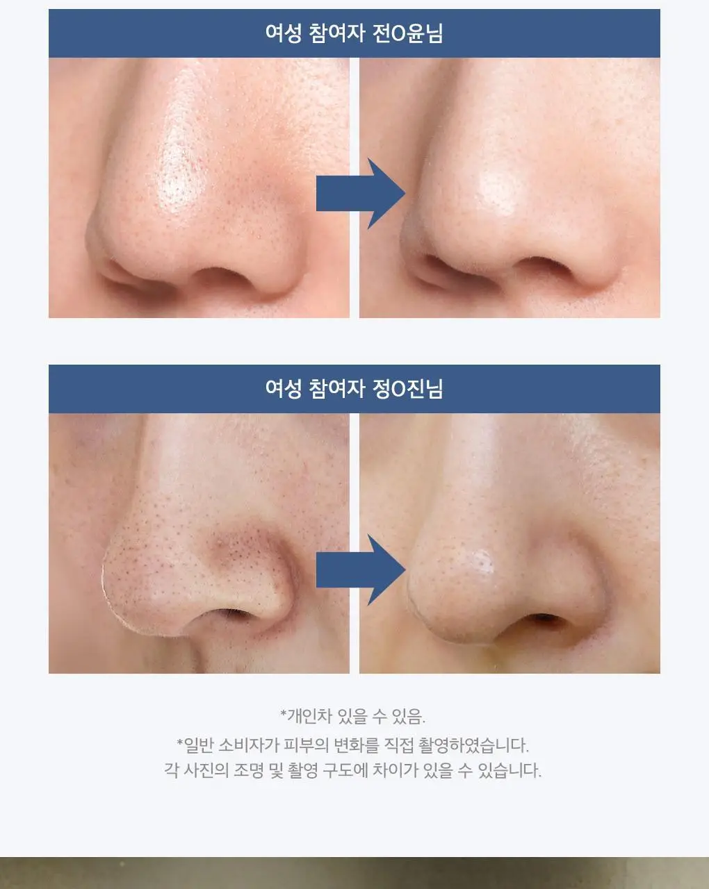 [블랙헤드관리/김다혜PICK] 비프로젝트 바이 블랙헤드 멜팅 리무버 30ml 상세페이지 22